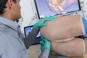 Prostate Massage aron madugangan ang usa ka miyembro
